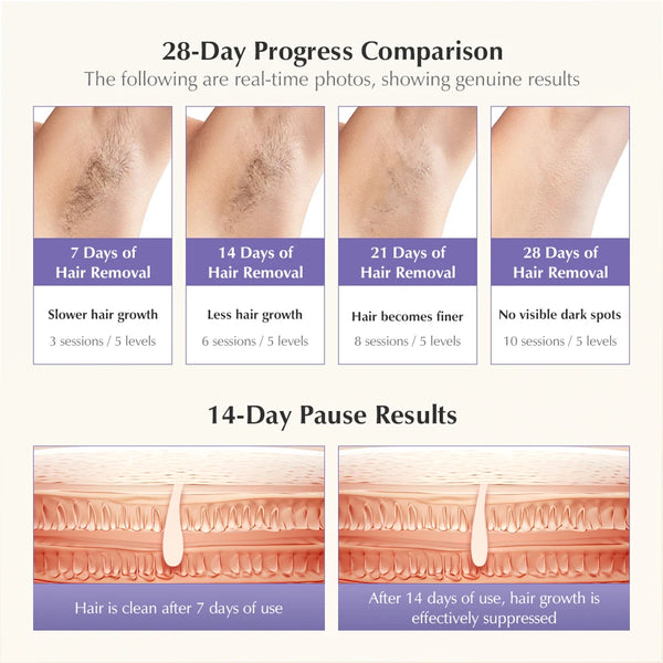 T14-Laser-Hair-Removal-IPL-Laser-Epilator-ICE-Cold-500000-Flashes-3IN1Automat-Home-use-For-Women.jpg