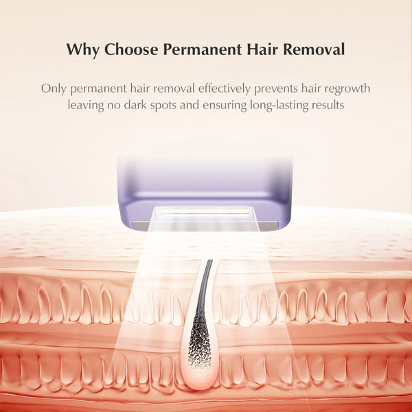 SmoothSkin IPL Hair Remover